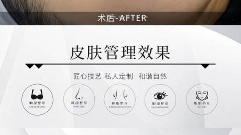 激光美容与光子嫩肤：揭秘价格背后的秘密