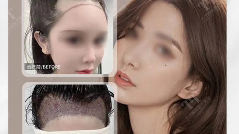 皮肤管理门店运营流程SOP：揭秘高效管理的秘密