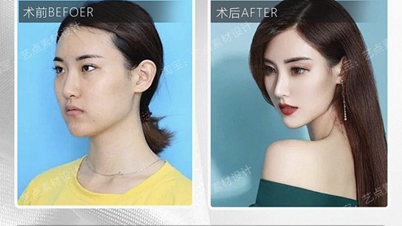国产激光美容仪器：揭秘其技术优势与选购要点