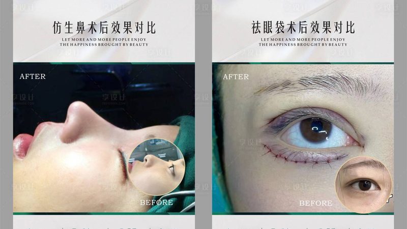 进口水光针VS国产：揭秘差异，选对才是关键