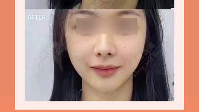 轻医美VS手术医美：揭秘两种美容方式的本质区别