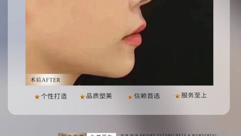 热玛吉定制探头：揭秘其背后的技术奥秘与选购要点**