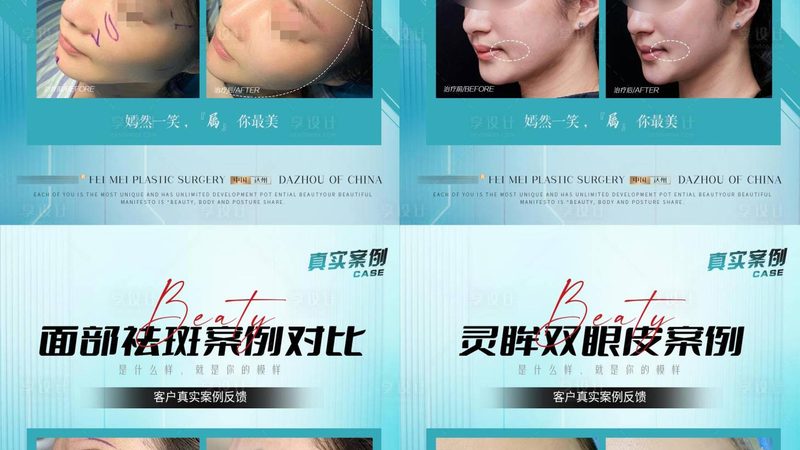 小型激光脱毛机：保养与注意事项全解析**