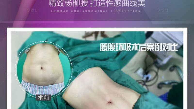 热玛吉副作用处理与真伪辨别技巧解析
