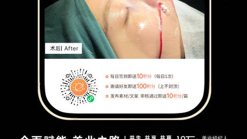 热玛吉2025价格解析：揭秘热玛吉市场背后的秘密