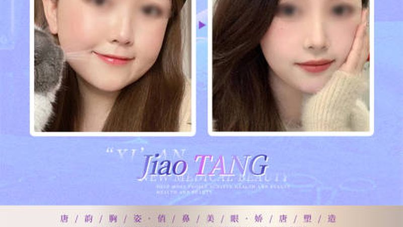 近年来，广州地区涌现出不少热玛吉厂家，以下是一些知名厂家的简要分析：