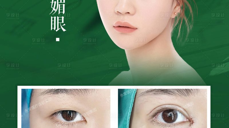 判断双眼皮埋线术后一周的效果，可以从以下几个方面进行：