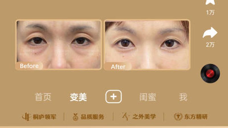 面部整形项目解析：揭秘你的美丽蜕变之路