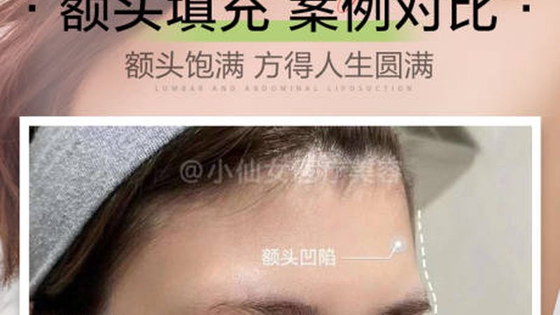 一般来说，除皱针注射后6小时左右可以正常洗脸。但在这期间，需要注意以下几点：